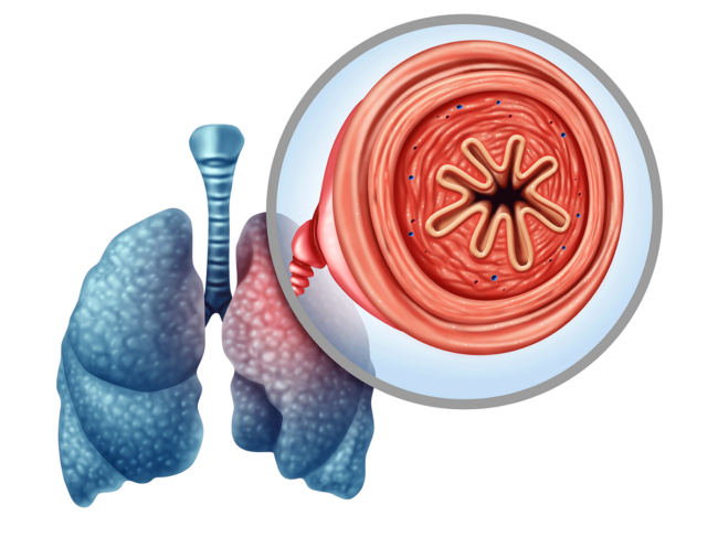 Lungs and bronchiole